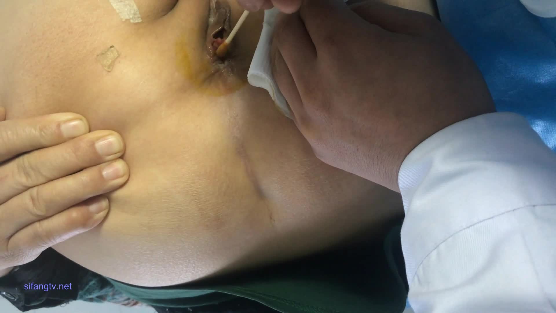 某房流出【医院身体检查 】偷拍少女少妇 做心电图 菊花消毒等等合集【48v】 (22)