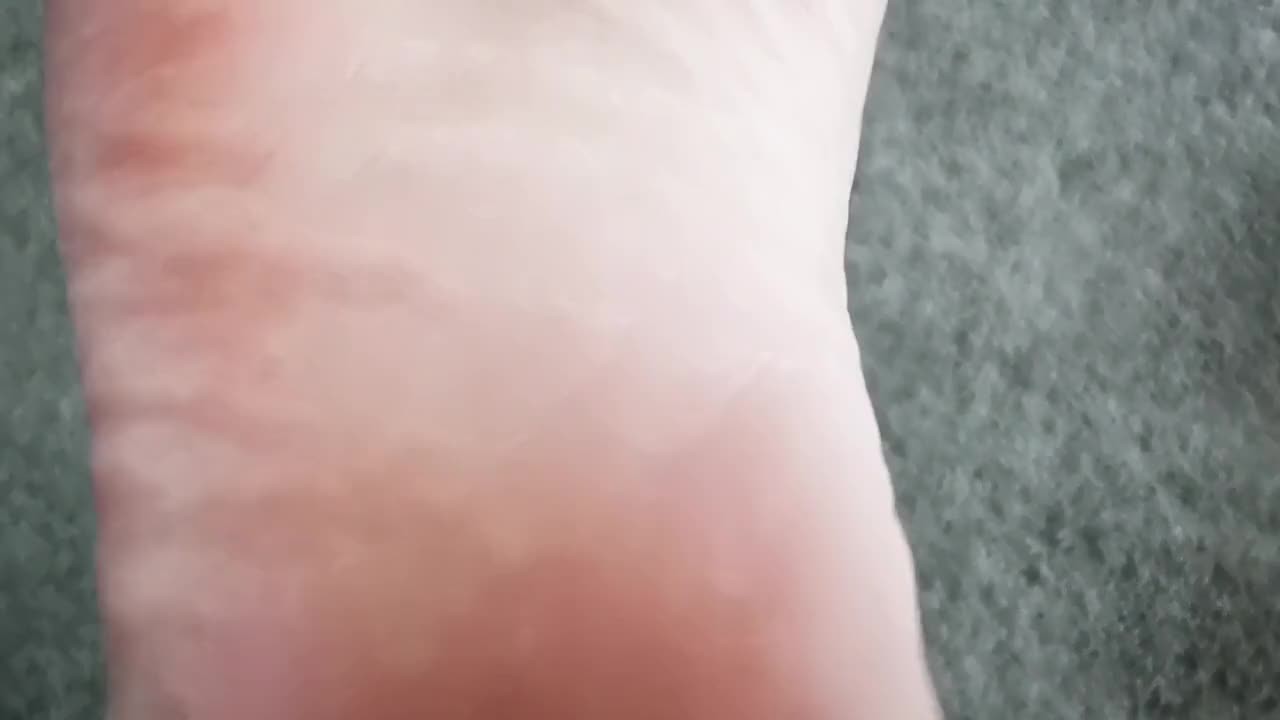 Foot Sole Close Up (ph5cf86e6809f9f)